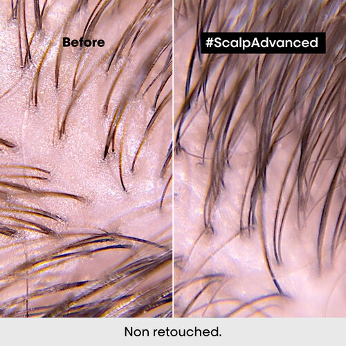 Scalp Advanced Anti-Oiliness 2-in-1 Deep Purifier Clay - Scalp Advanced | L'Or&eacute;al Partner Shop